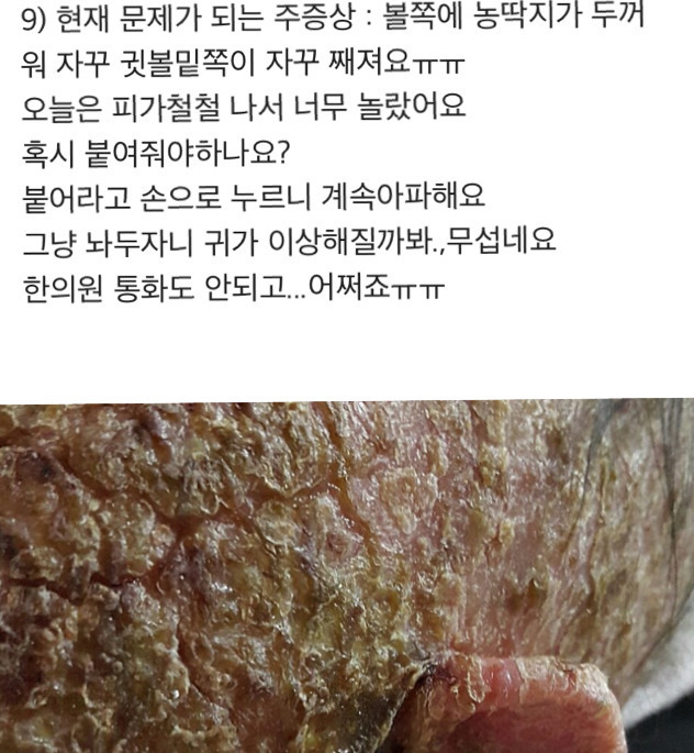 아기 약 안먹이고 자연 치유 시키는 안아키 라는 카페.jpg (혐오주의) | 인스티즈