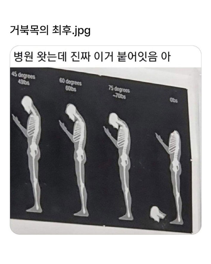거북목의 최후 | 인스티즈