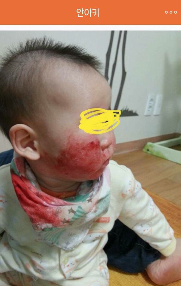 아기 약 안먹이고 자연 치유 시키는 안아키 라는 카페.jpg (혐오주의) | 인스티즈