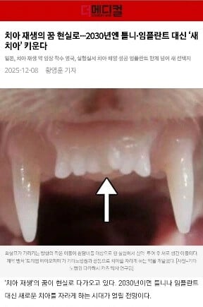 일본 치아 재생 근황 | 인스티즈