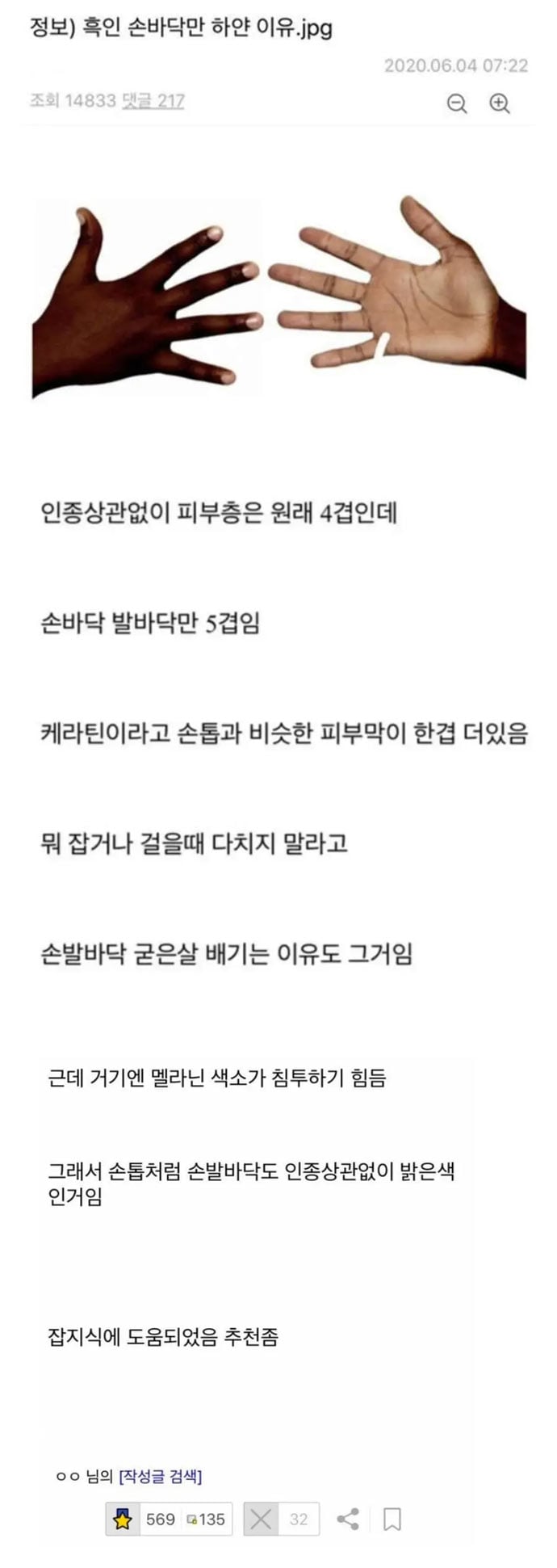 흑인 손바닥이 하얀 이유 | 인스티즈