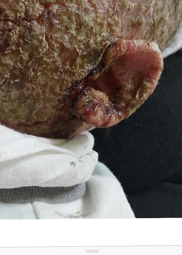 아기 약 안먹이고 자연 치유 시키는 안아키 라는 카페.jpg (혐오주의) | 인스티즈