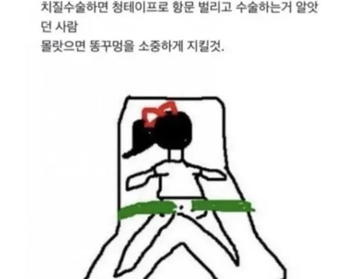 X구멍을 소중히 여기지 않으면 | 인스티즈