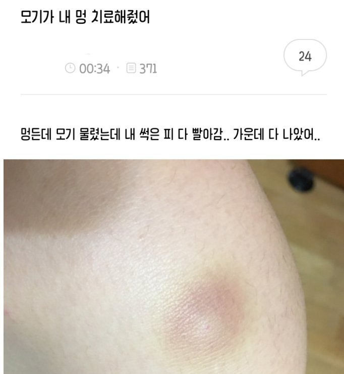 피 맛이 이상해 | 인스티즈