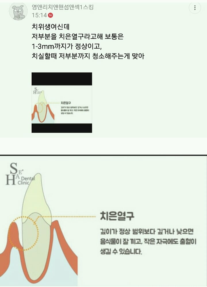 치실 해도 나는 음식물이나 그런거 하나도 안나와.. | 인스티즈
