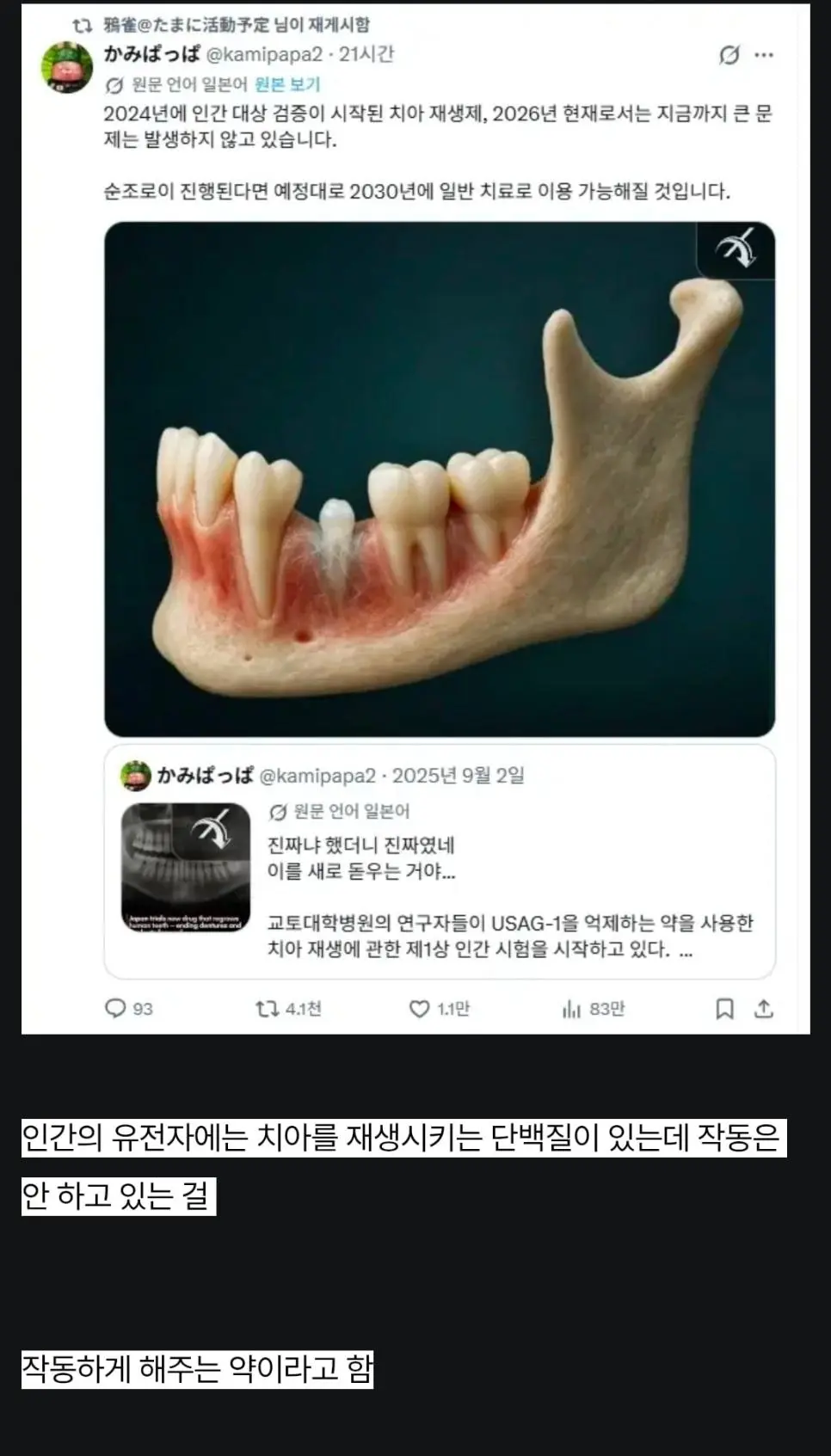 치아 재생 근황 | 인스티즈