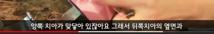 치실 해도 나는 음식물이나 그런거 하나도 안나와.. | 인스티즈