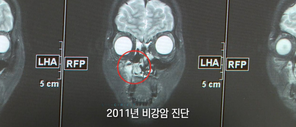 13살 딸까지 덮친 치명적 가족력 | 인스티즈
