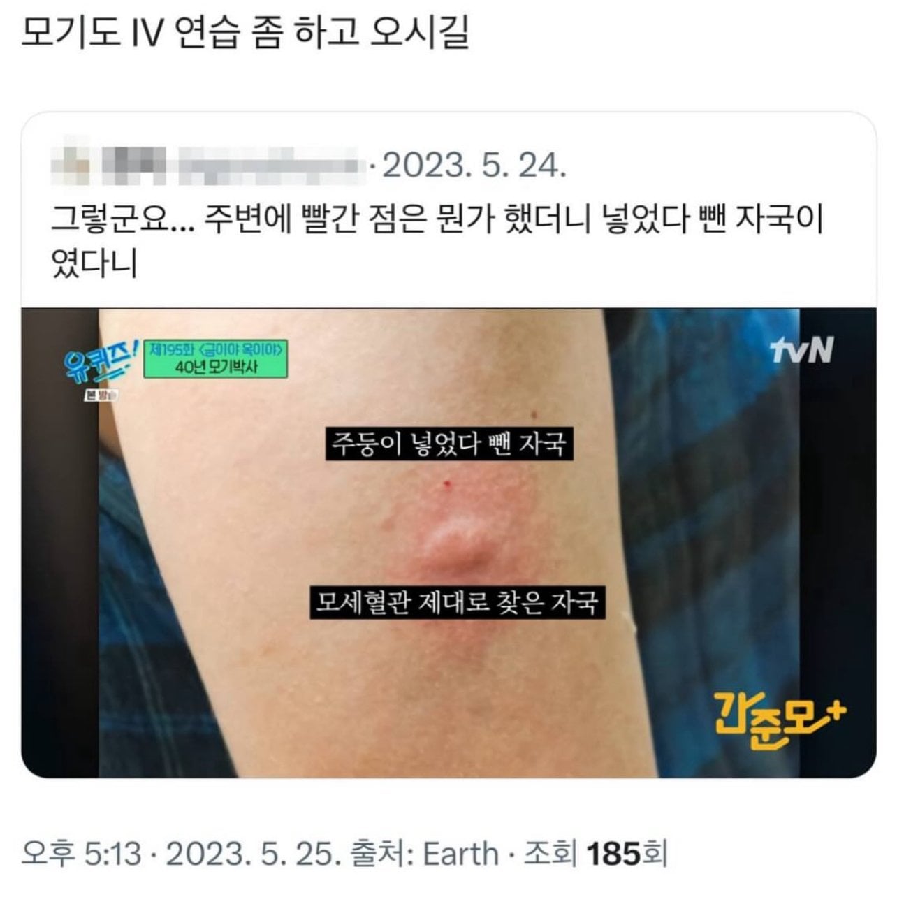 모기 물린 자국 옆 빨간 점은 무엇일까 | 인스티즈