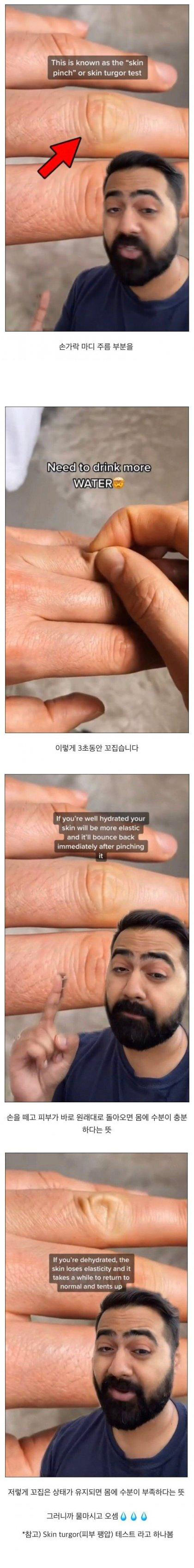 수분부족 테스트 | 인스티즈