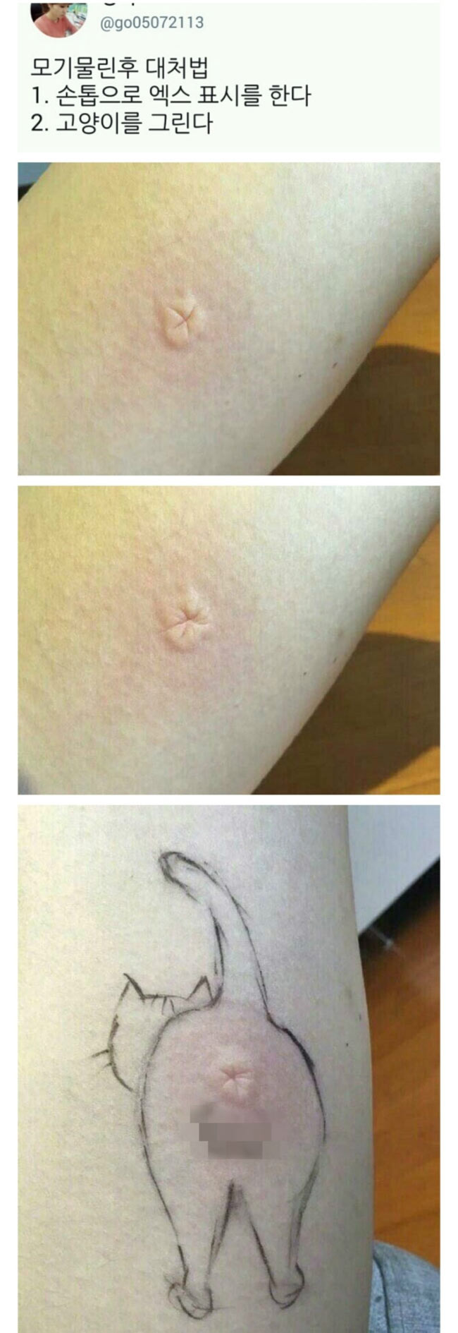 모기 물린 후 대처법 | 인스티즈
