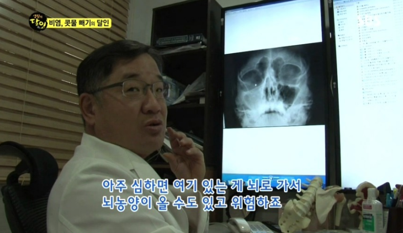 보는 내가 다 후련한 생활의달인 비염/콧물의 달인편.jpg (충격주의) | 인스티즈