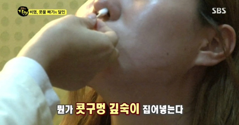 보는 내가 다 후련한 생활의달인 비염/콧물의 달인편.jpg (충격주의) | 인스티즈