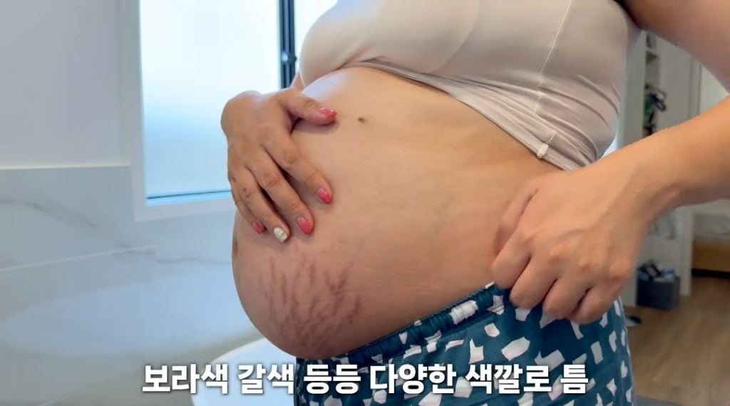 임신 후 몸에 생긴 날것의 변화 | 인스티즈