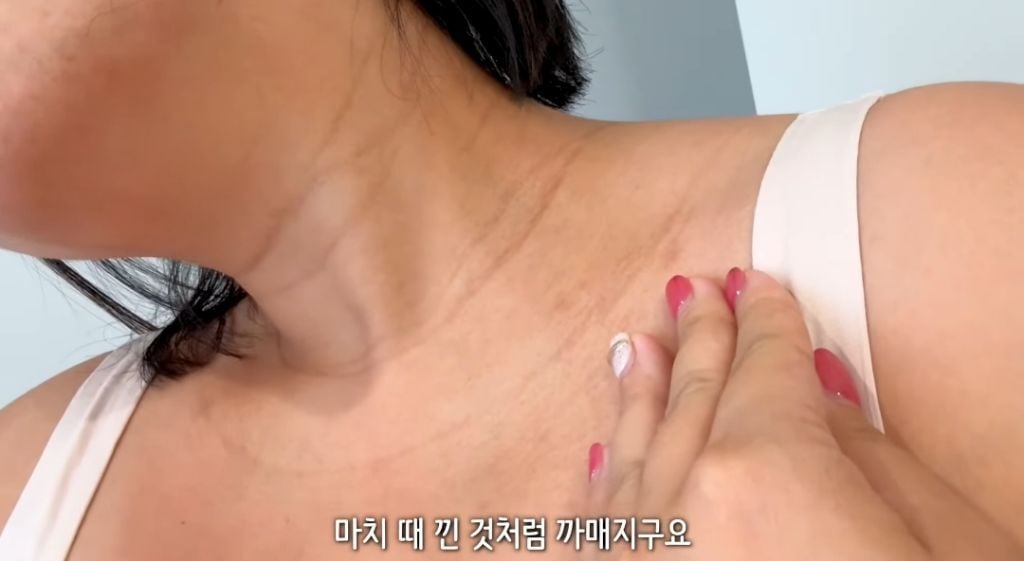 임신 후 몸에 생긴 날것의 변화 | 인스티즈