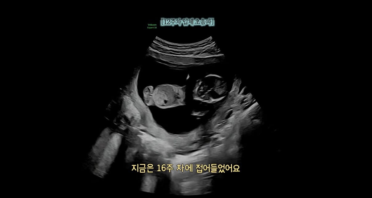 나는솔로 28기 돌싱특집 옥순 영호 둘째 임신 | 인스티즈