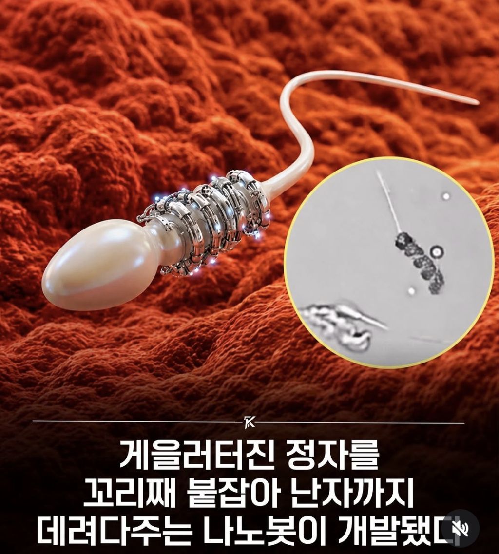 게을러터진 정자를 꼬리째 붙잡아 난자까지 데려다주는 나노봇 개발 | 인스티즈
