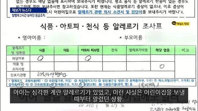 알러지 있다고 밝히는 사람들이 겪는 짜증나는 상황들 | 인스티즈