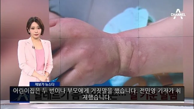 알러지 있다고 밝히는 사람들이 겪는 짜증나는 상황들 | 인스티즈