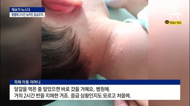 알러지 있다고 밝히는 사람들이 겪는 짜증나는 상황들 | 인스티즈