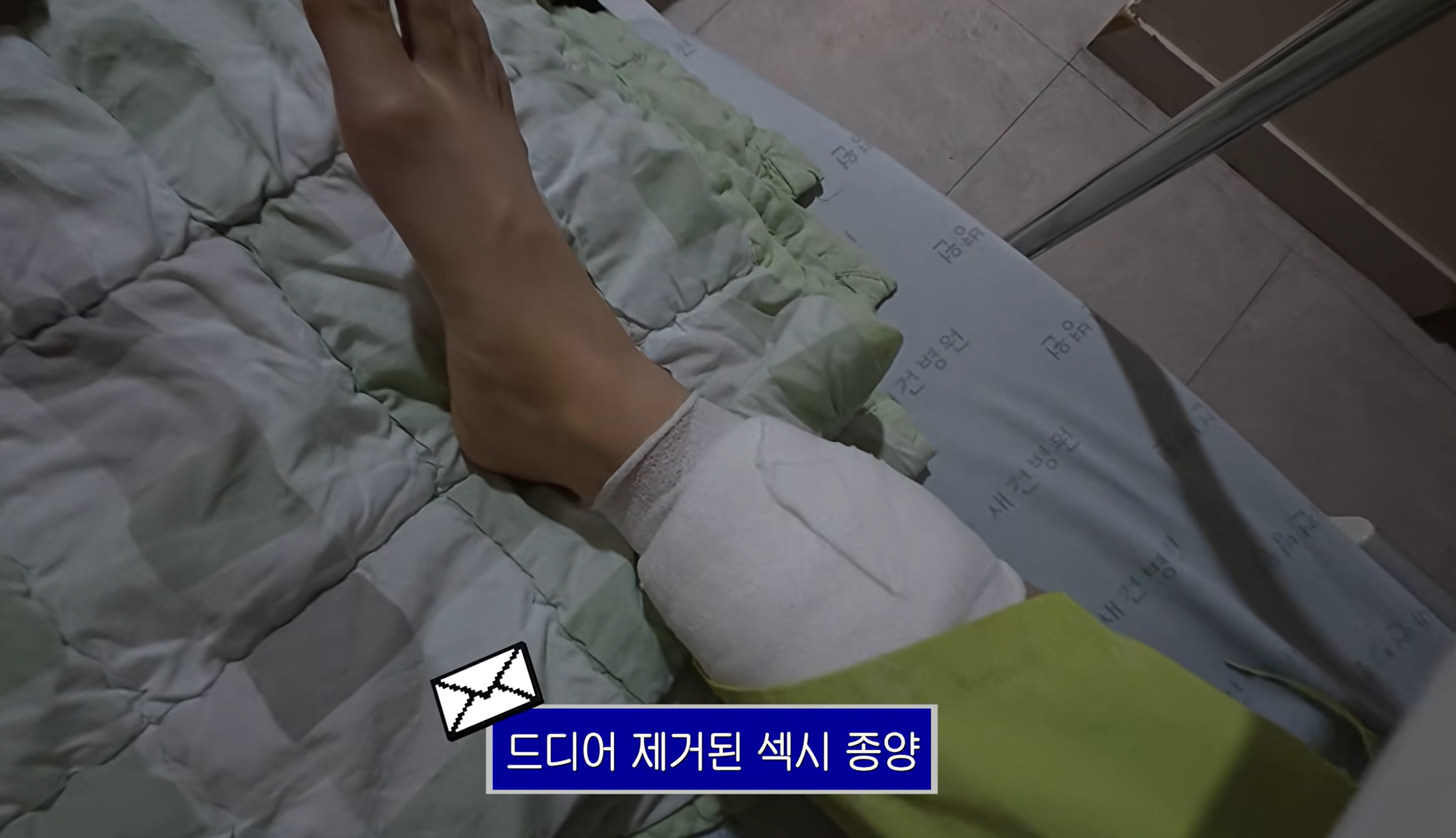 혈관종양 수술했다는 엄은향 | 인스티즈