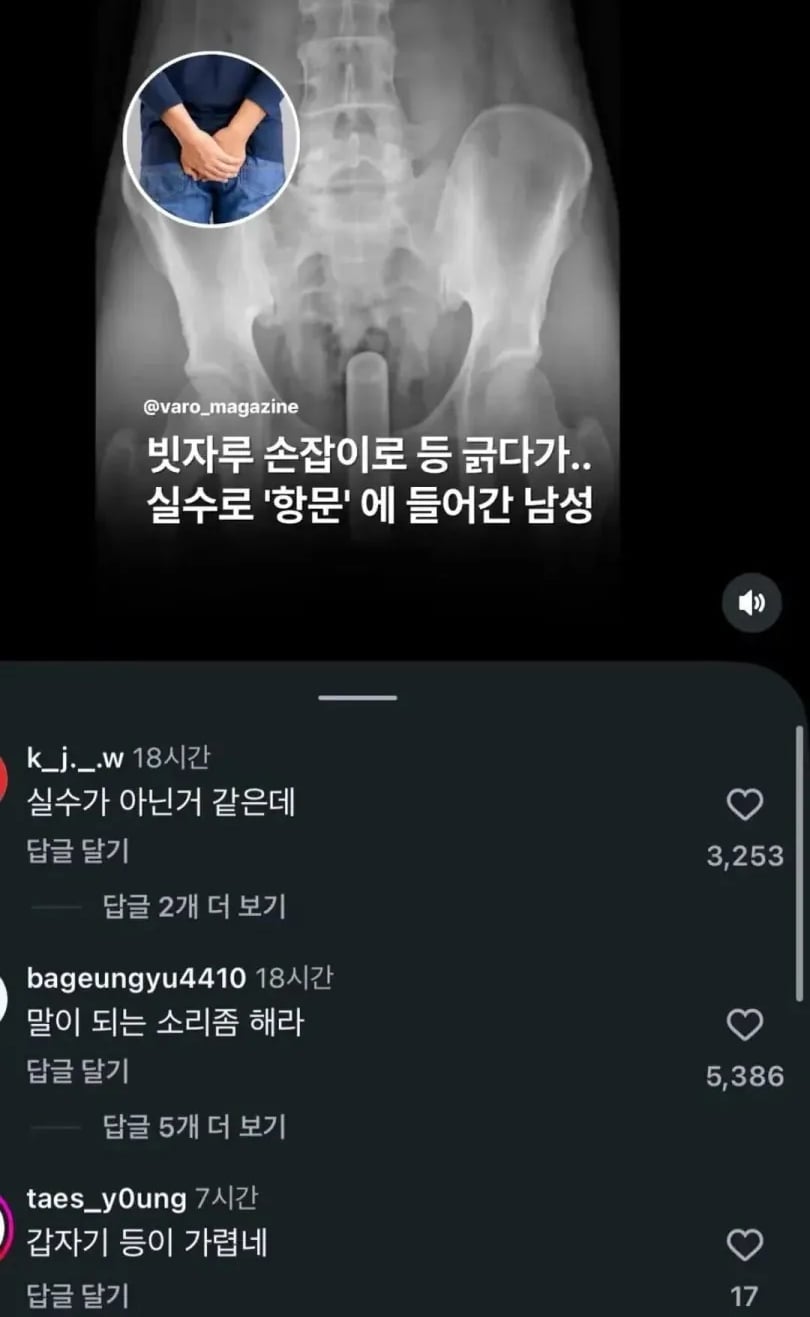 등 함부로 긁으면 위험한 이유 | 인스티즈