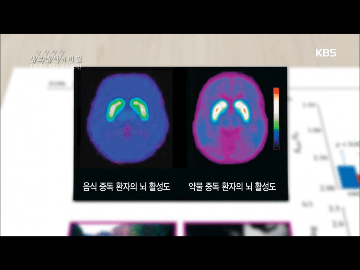 음식도 약물처럼 중독됨.jpg (생로병사의 비밀) | 인스티즈