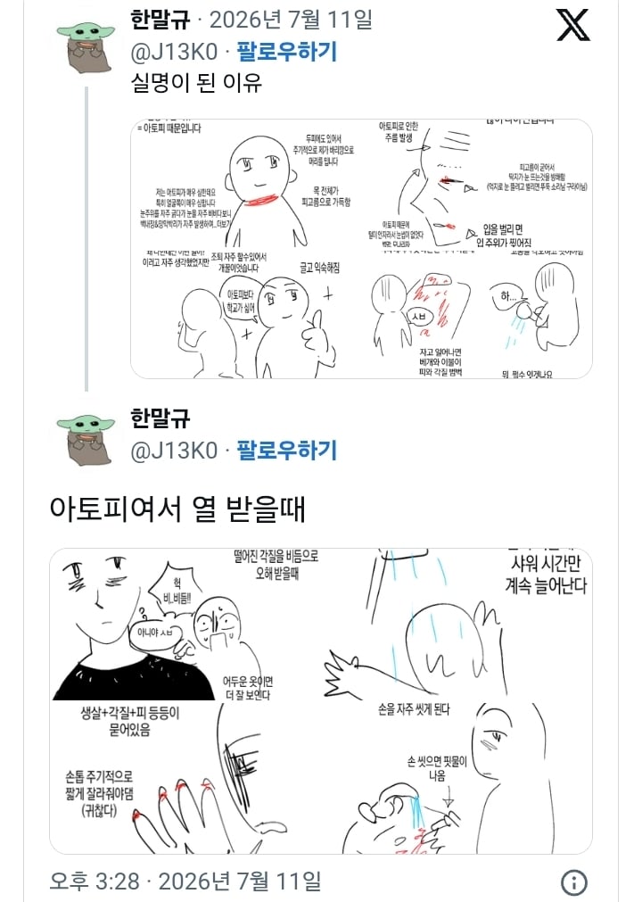 아토피가 정말 힘든 이유… | 인스티즈