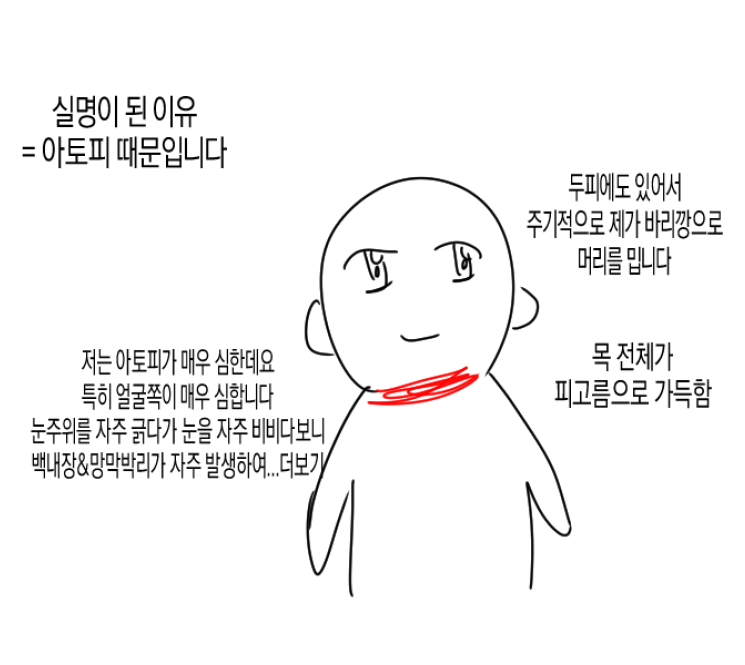 아토피가 정말 힘든 이유… | 인스티즈