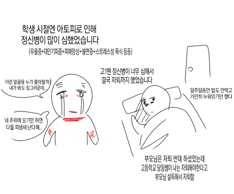 아토피가 정말 힘든 이유… | 인스티즈