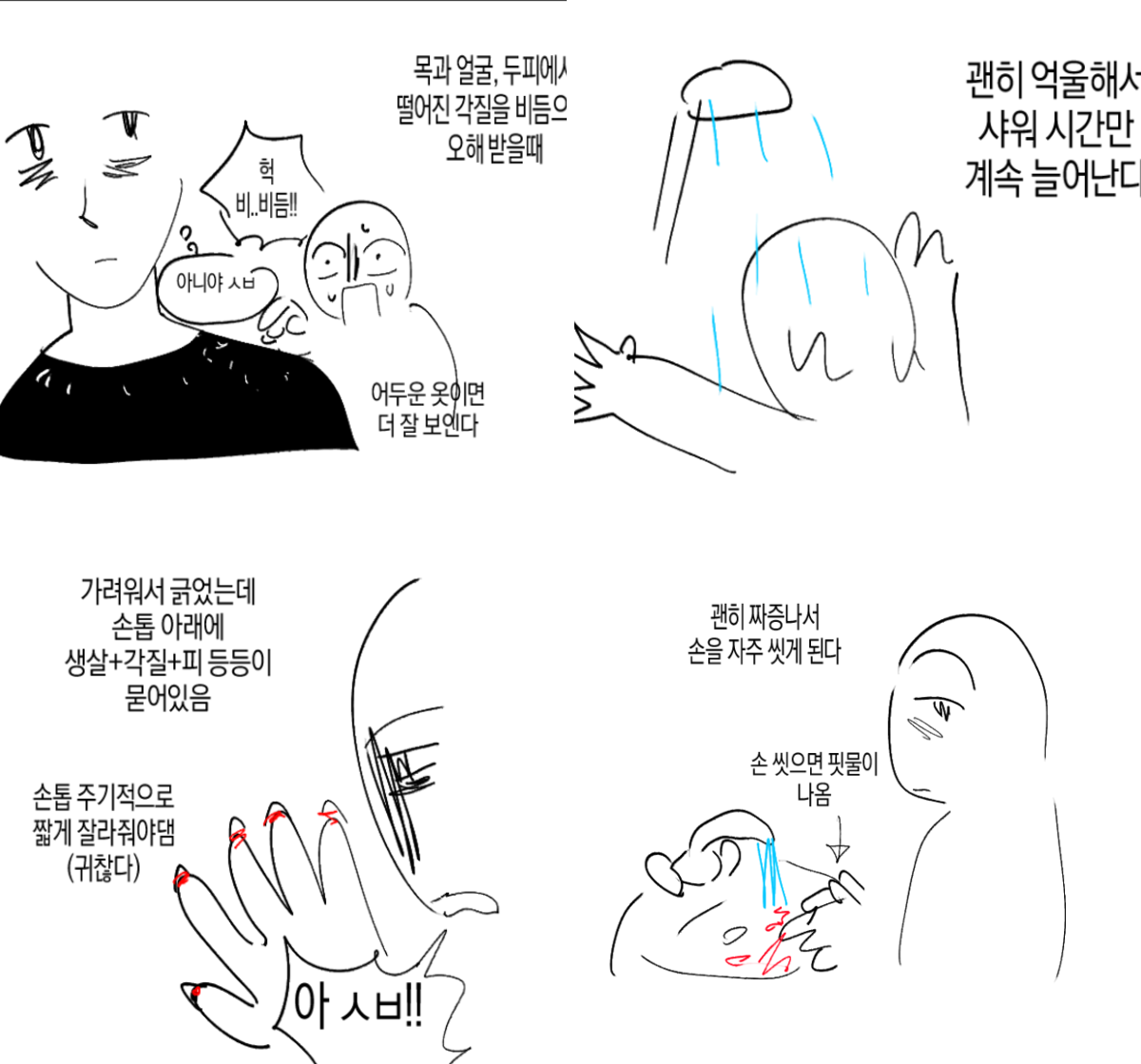 아토피가 정말 힘든 이유… | 인스티즈