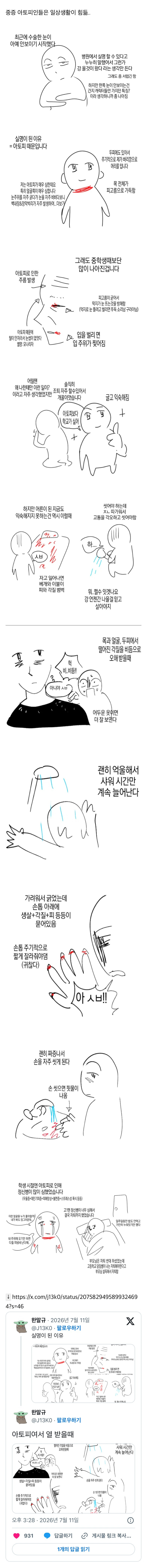 아토피가 정말 힘든 이유 | 인스티즈