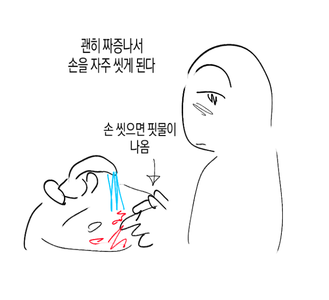 아토피가 정말 힘든 이유… | 인스티즈