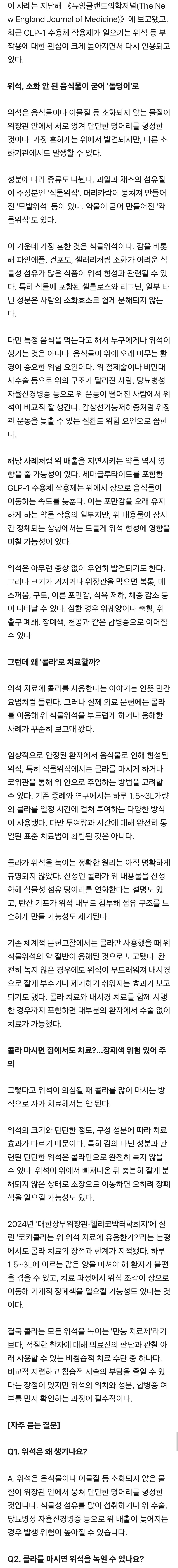 "콜라 1.5L 마셔라” 의사의 뜻밖 처방…위 속 돌덩이 사라졌다 | 인스티즈