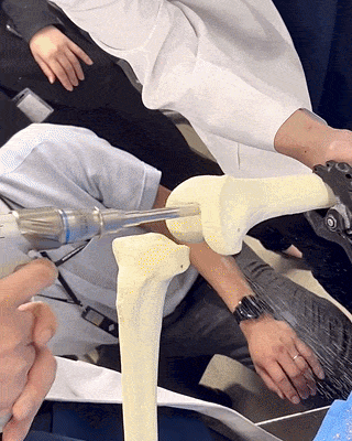 내 관절이 다 시리는 인공 관절 수술.GIF | 인스티즈