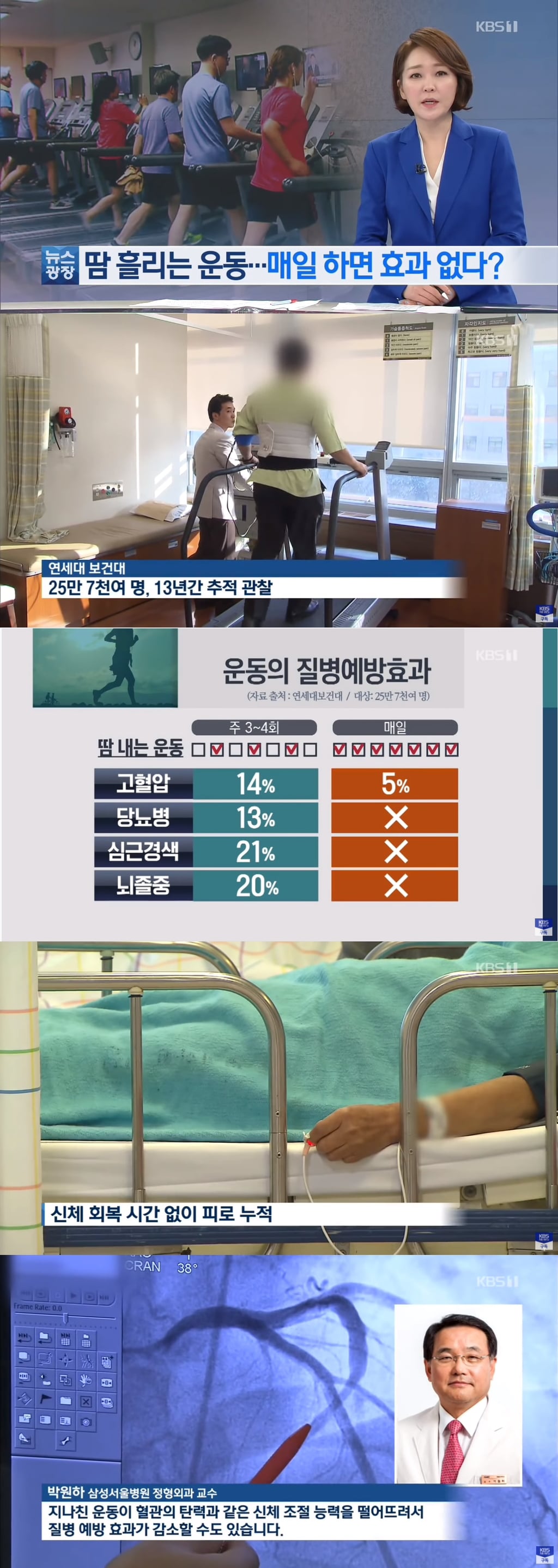 다이어트 할 때 주5일 운동이 좋다 vs 격일 운동이 좋다 | 인스티즈