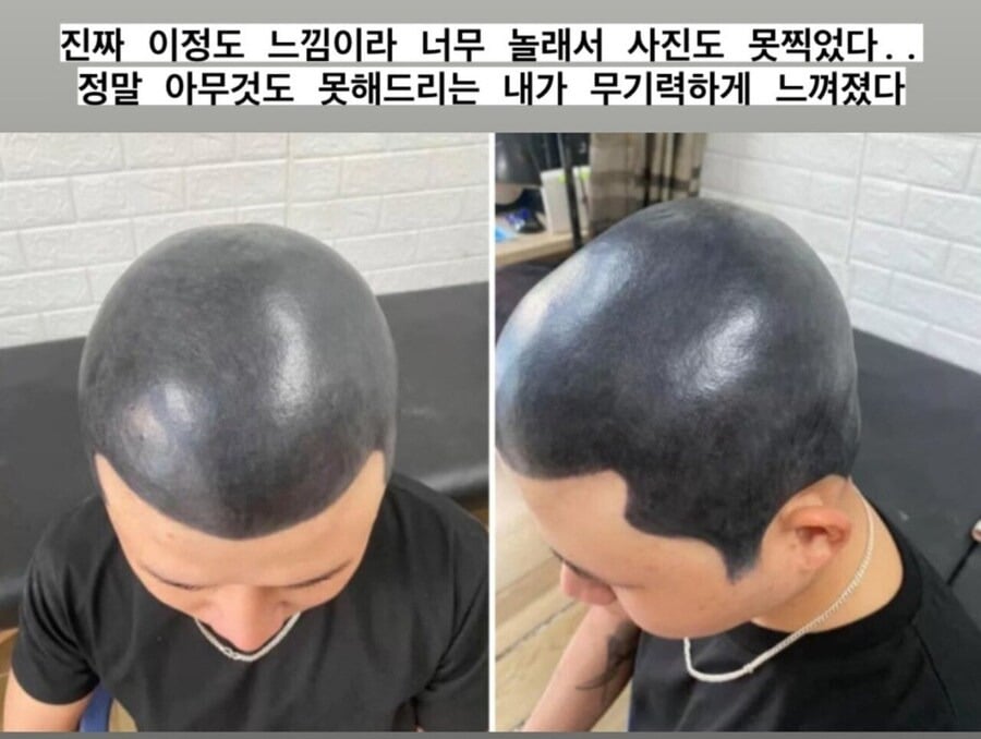 역대급으로 망해서 사진도 못 찍을 정도였다는 두피 문신.jpg | 인스티즈