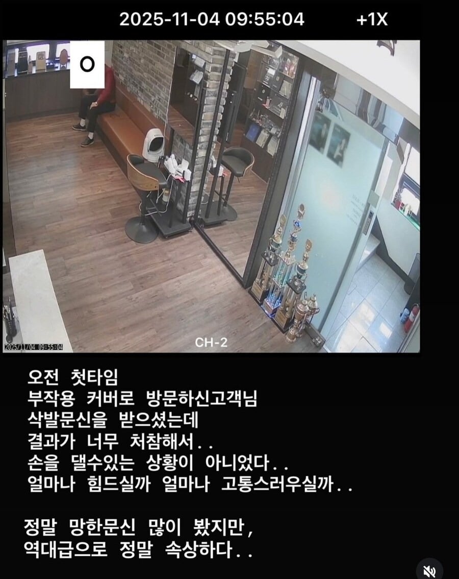 역대급으로 망해서 사진도 못 찍을 정도였다는 두피 문신.jpg | 인스티즈