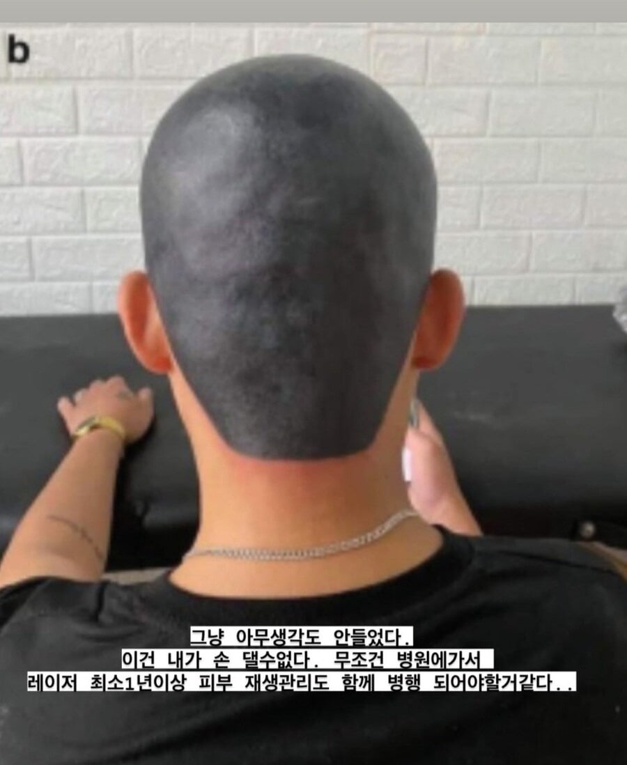역대급으로 망해서 사진도 못 찍을 정도였다는 두피 문신.jpg | 인스티즈