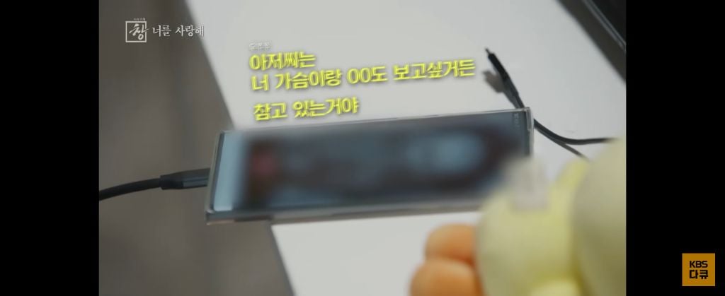 위고비 왜하냐 이거보면 없던 입맛도 떨어지는데 | 인스티즈