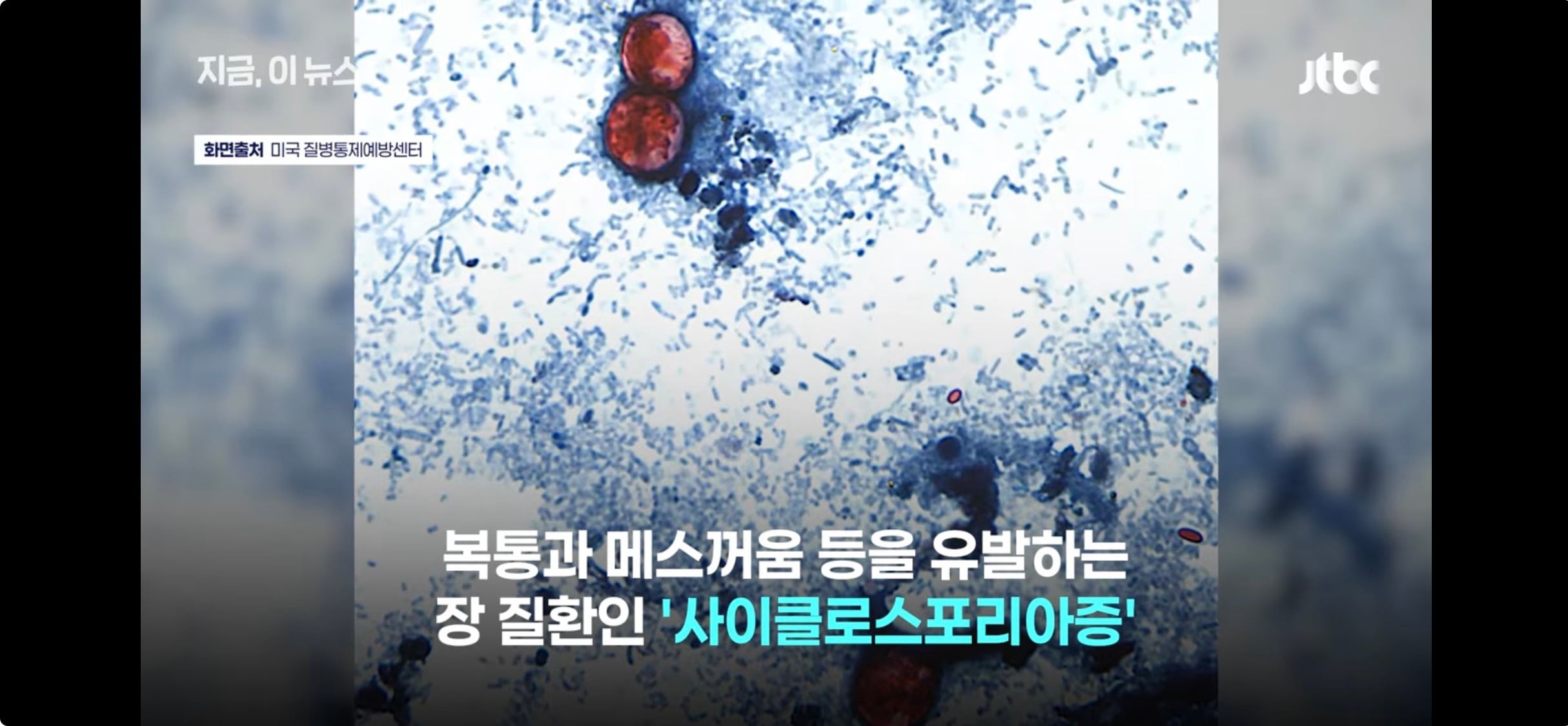 세척해도 안 죽는다, 미국 덮친 기생충 감염 급증 | 인스티즈