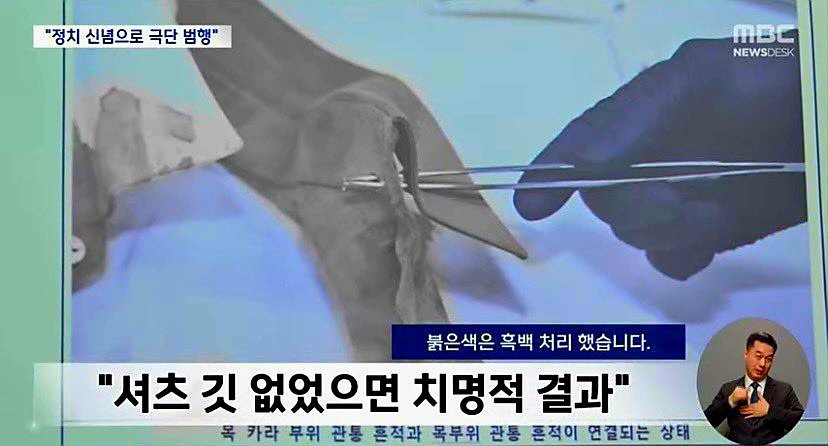 이재명 테러사건에서 18cm짜리 개조흉기를 커터칼로 축소 기재한 김 전 검사 | 인스티즈