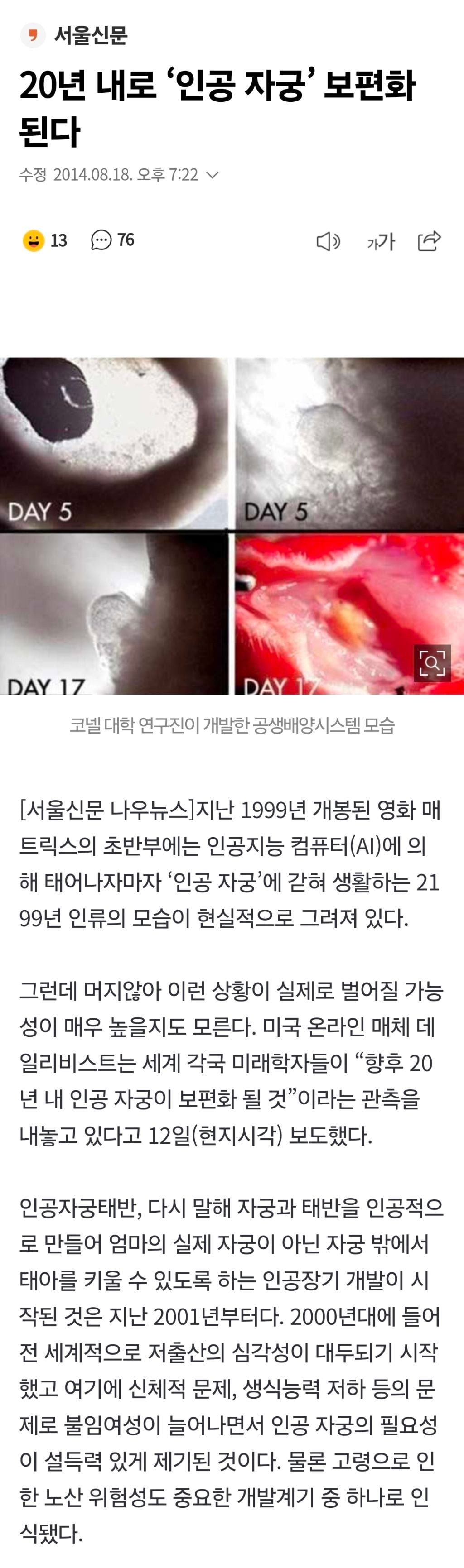 20년 내로 '인공 자궁' 보편화 된다 | 인스티즈