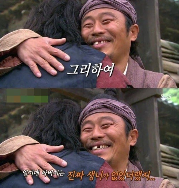 드라마를 위해 실제 생니를 뽑은 배우 | 인스티즈