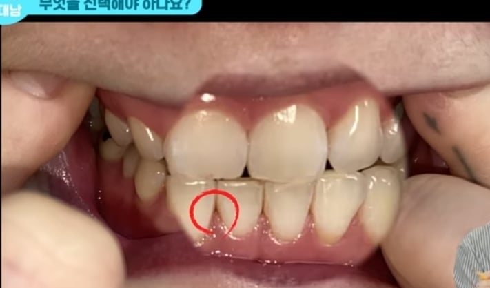 치실 대신 워터픽 쓰면 안됨? 워터픽 이름이 물치실이잖아 | 인스티즈