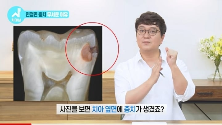 치실 대신 워터픽 쓰면 안됨? 워터픽 이름이 물치실이잖아 | 인스티즈