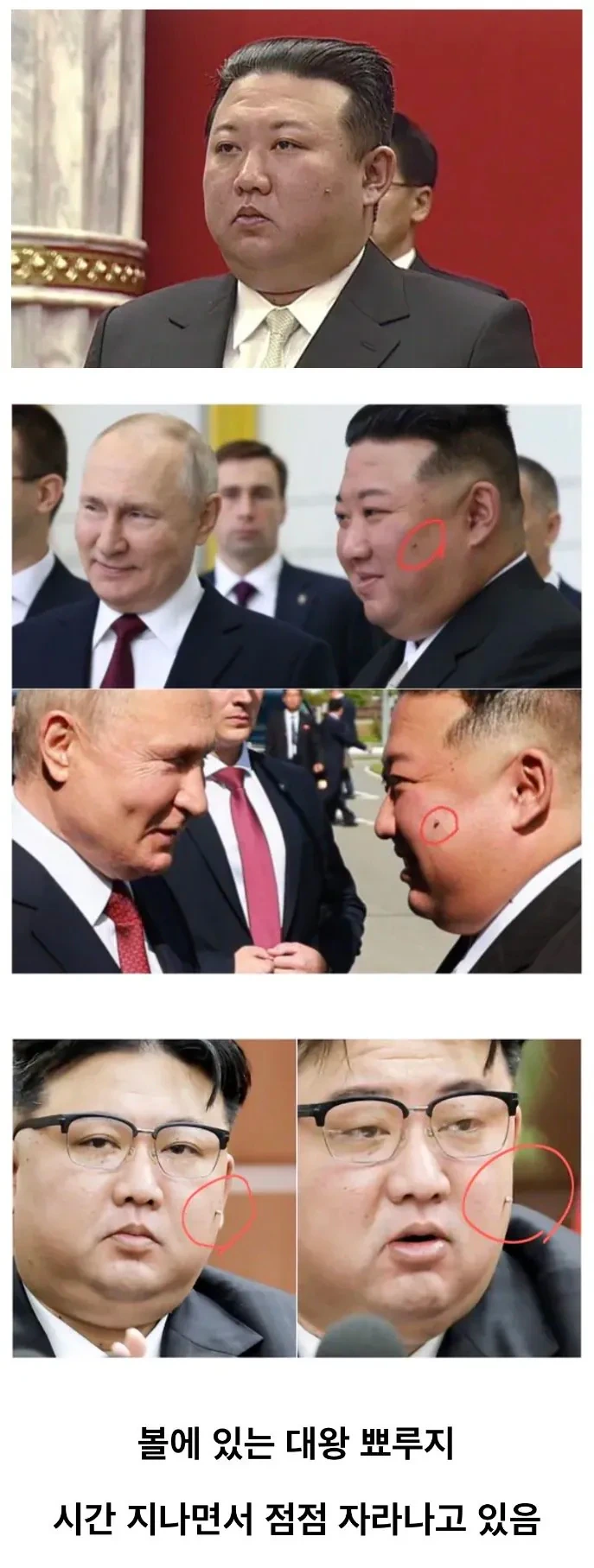 김정은 얼굴에서 점점 자라나고 있는 것 | 인스티즈